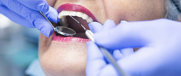 Best Emergency Wisdom Teeth Removal in Smyrna, TN